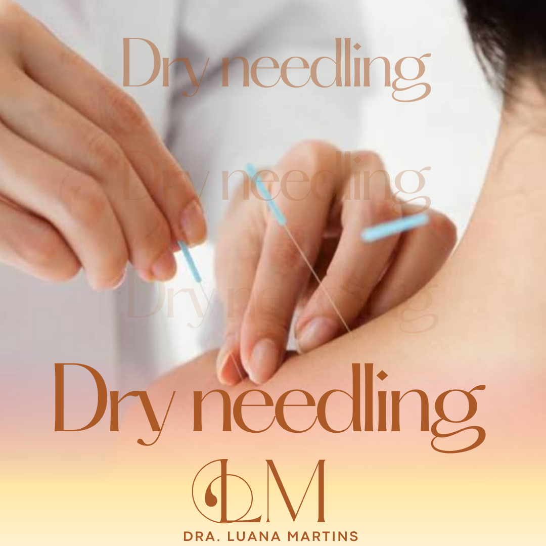 Imagem de dry needling